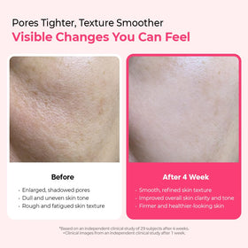 Dr.Melaxin Cyano Pink Spicule Serum application on hand