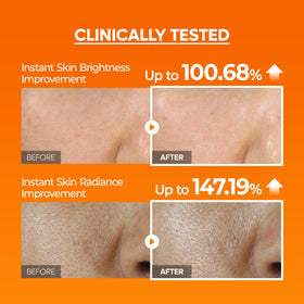 Dr.Melaxin Glow Rice Peeling Ampoule ingredients list