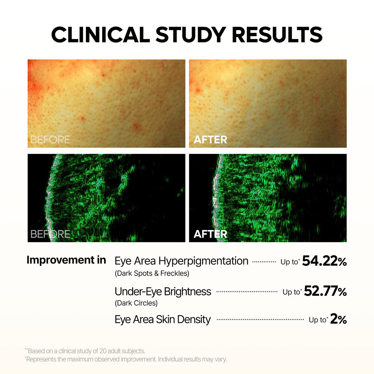 Dr.Melaxin Kojic Acid Eye Patch application on a model's eyes
