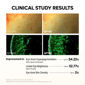 Dr.Melaxin Kojic Acid Eye Patch application on a model's eyes