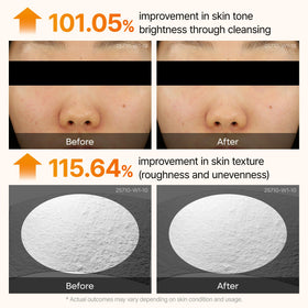 Dr.Melaxin Kojic Acid Turmeric Serum application on skin