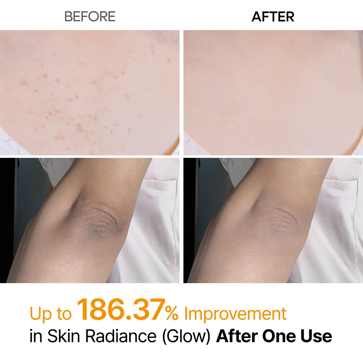 Dr.Melaxin Peel Shot Kojic Acid Turmeric Body Exfoliator Spray back view