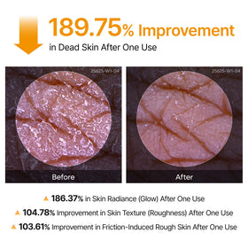Dr.Melaxin Peel Shot Kojic Acid Turmeric Body Exfoliator Spray in lifestyle setting