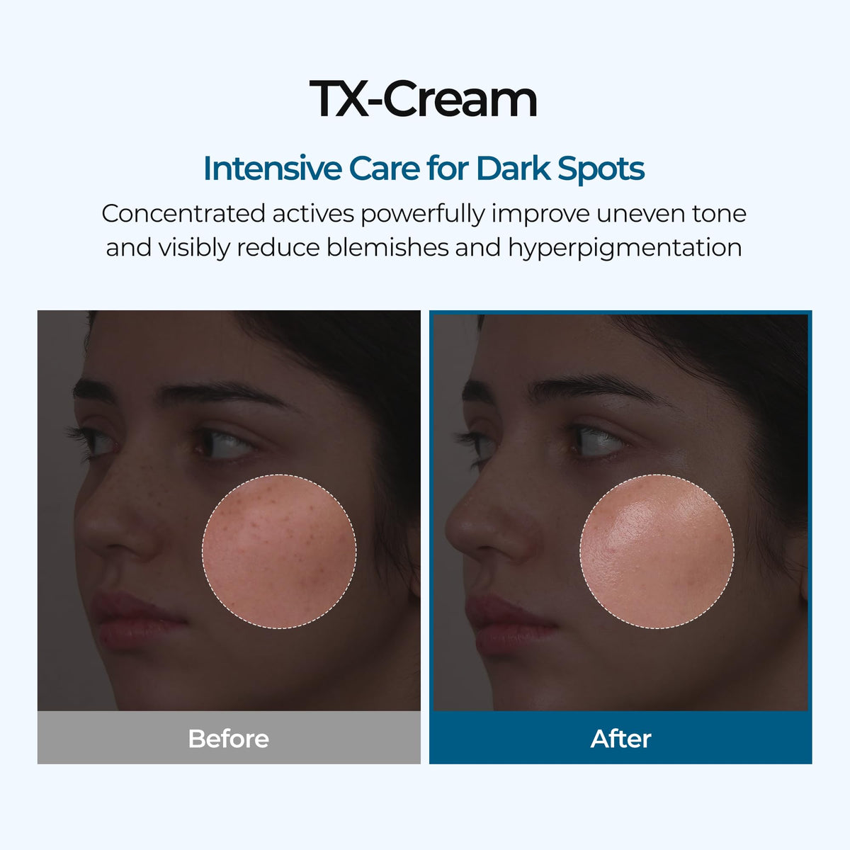 Dr.Melaxin TX Tranexamic Acid Cream 50ml packaging