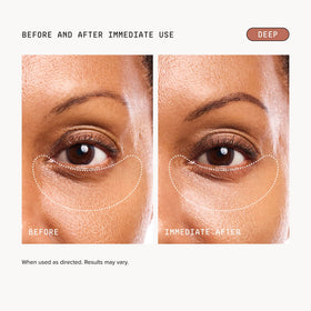 DRMTLGY Luminous Eye Corrector SPF 41 Deep texture close-up