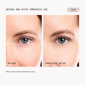 DRMTLGY Luminous Eye Corrector SPF 41 Fair on a model's under-eye area