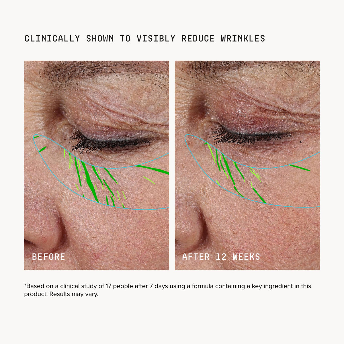DRMTLGY Needle-less Growth Factor Serum application on skin