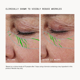 DRMTLGY Needle-less Growth Factor Serum application on skin
