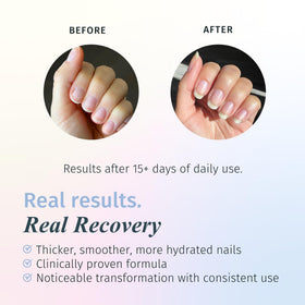 duri Rejuvacote 1 Nail Growth System bottle side view