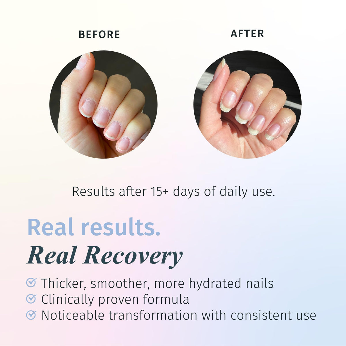 duri Rejuvacote 1 Nail Strengthener bottle close-up