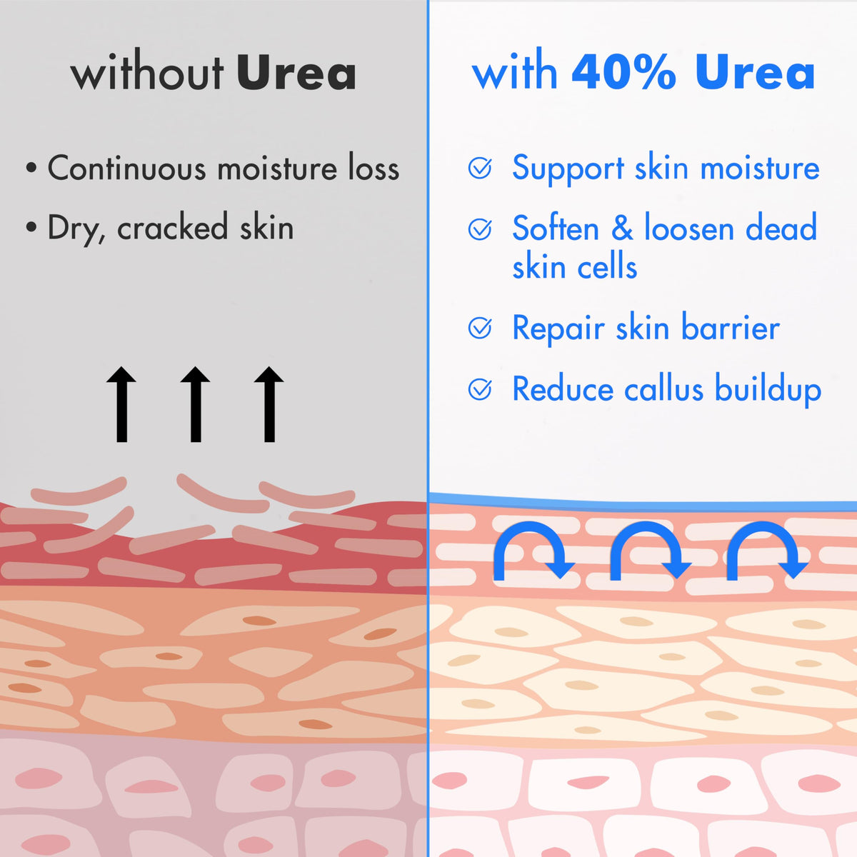 Ebanel Urea Cream 40% close-up of cream texture