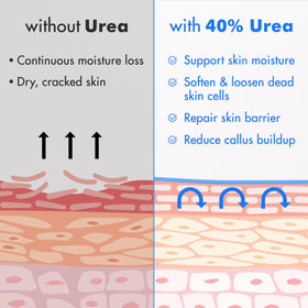 Ebanel Urea Cream 40% close-up of cream texture