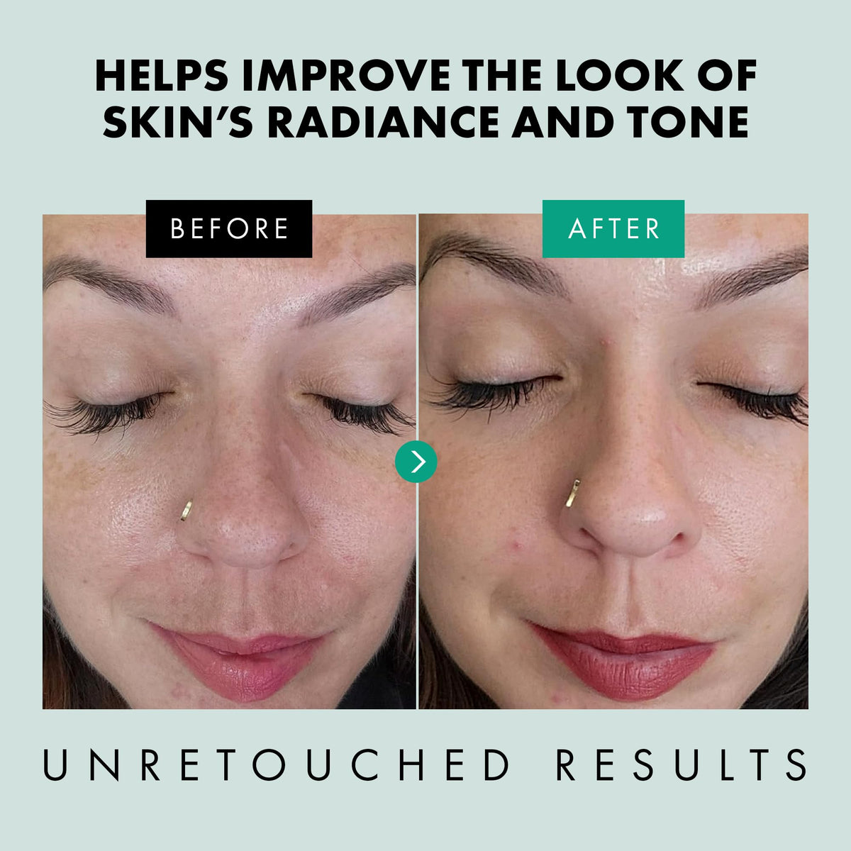Eclat Skincare Niacinamide Serum 12% on wooden surface