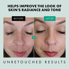 Eclat Skincare Niacinamide Serum 12% on wooden surface