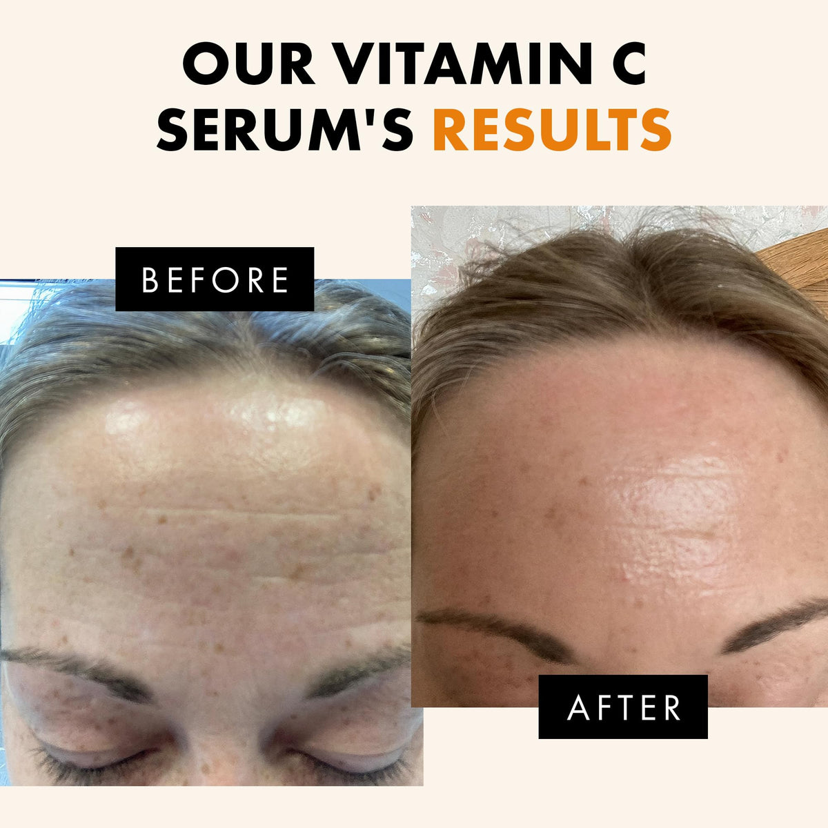 Eclat Skincare Vitamin C Serum with hyaluronic acid ingredients