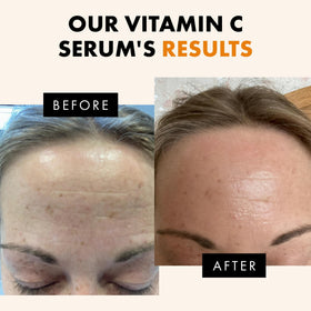 Eclat Skincare Vitamin C Serum with hyaluronic acid ingredients