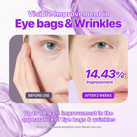 EIOM Hydrogel Eye Patches applied under eyes