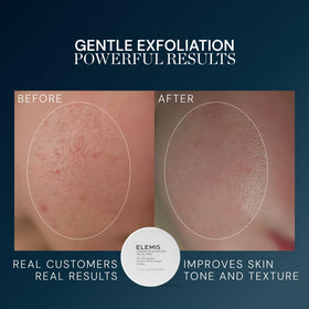 ELEMIS Dynamic Resurfacing Facial Pads showing smooth side