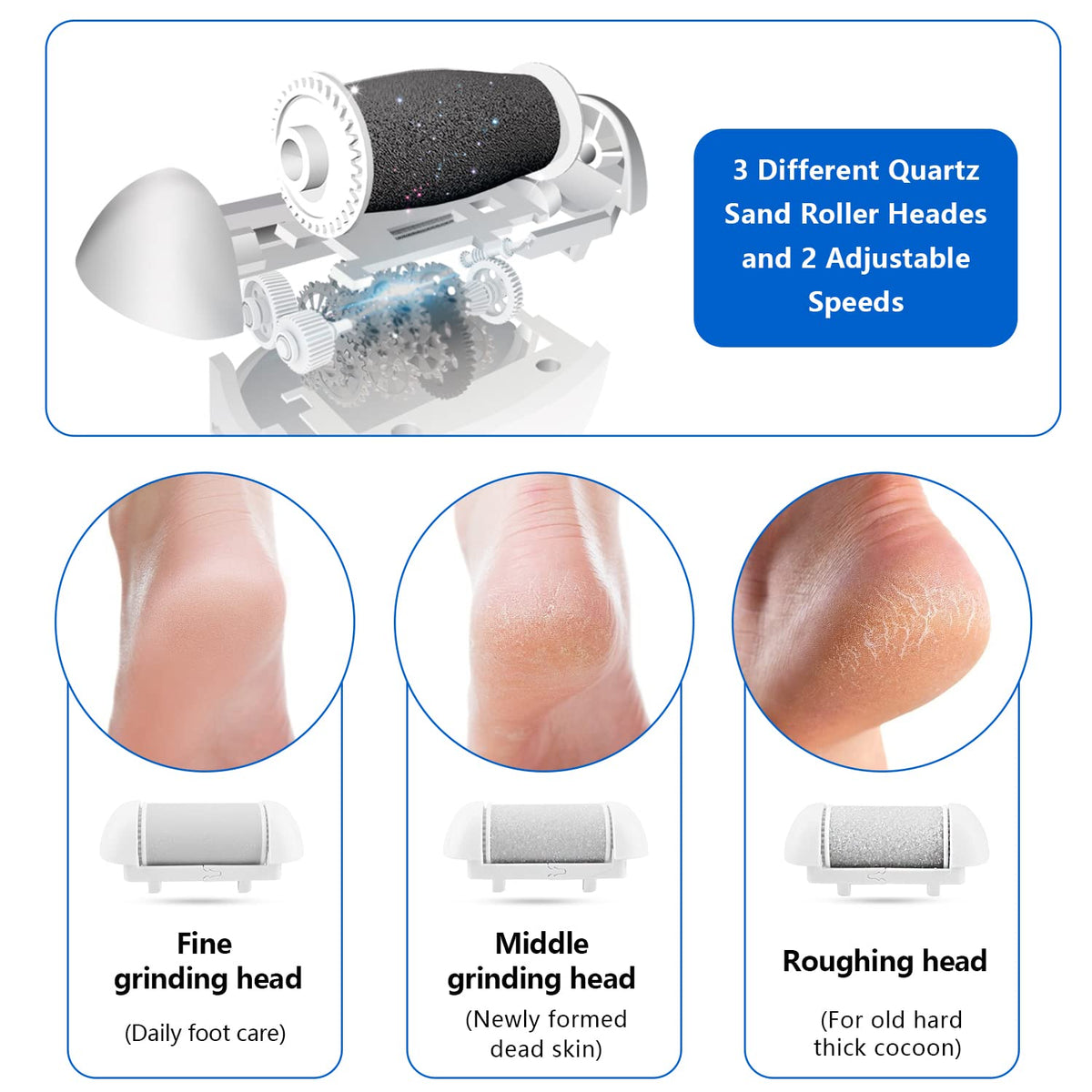 Elmchee Electric Foot Callus Remover in use on feet