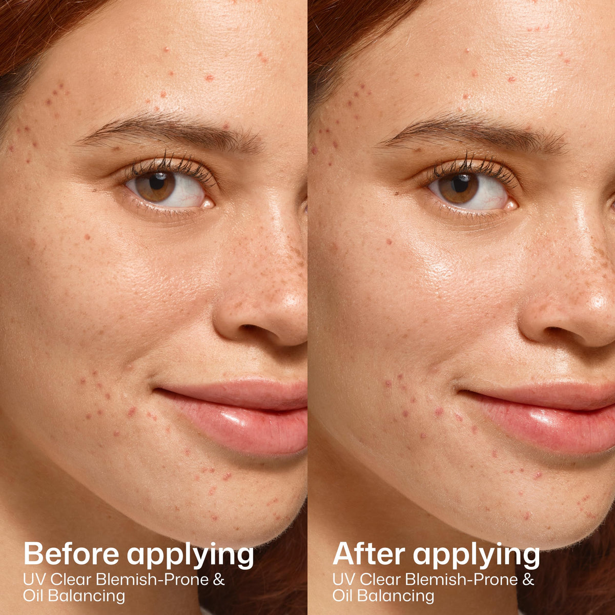 EltaMD UV Clear Blemish-Prone Oil Balancing SPF 50 in lifestyle setting