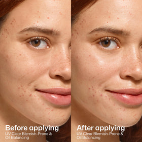 EltaMD UV Clear Blemish-Prone Oil Balancing SPF 50 in lifestyle setting
