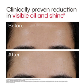 EltaMD UV Clear Blemish-Prone Oil Balancing SPF 50 packaging
