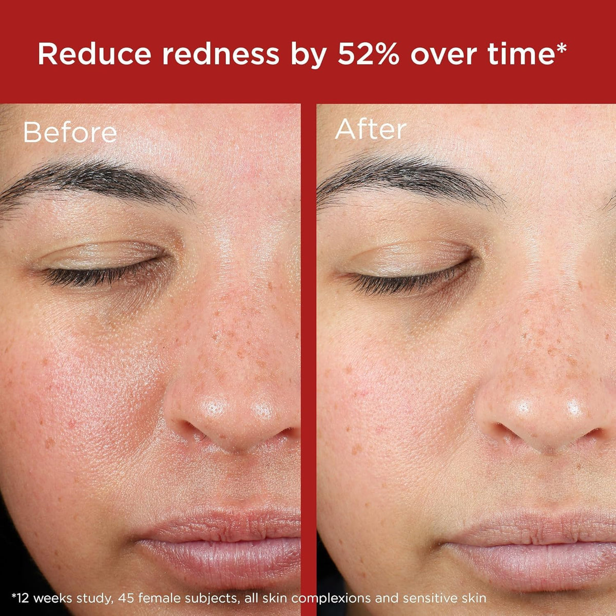 EltaMD UV Skin Recovery Face Sunscreen SPF 50 packaging