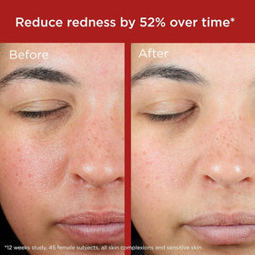 EltaMD UV Skin Recovery Face Sunscreen SPF 50 packaging