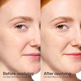 EltaMD UV Skin Recovery Green Tinted Sunscreen packaging