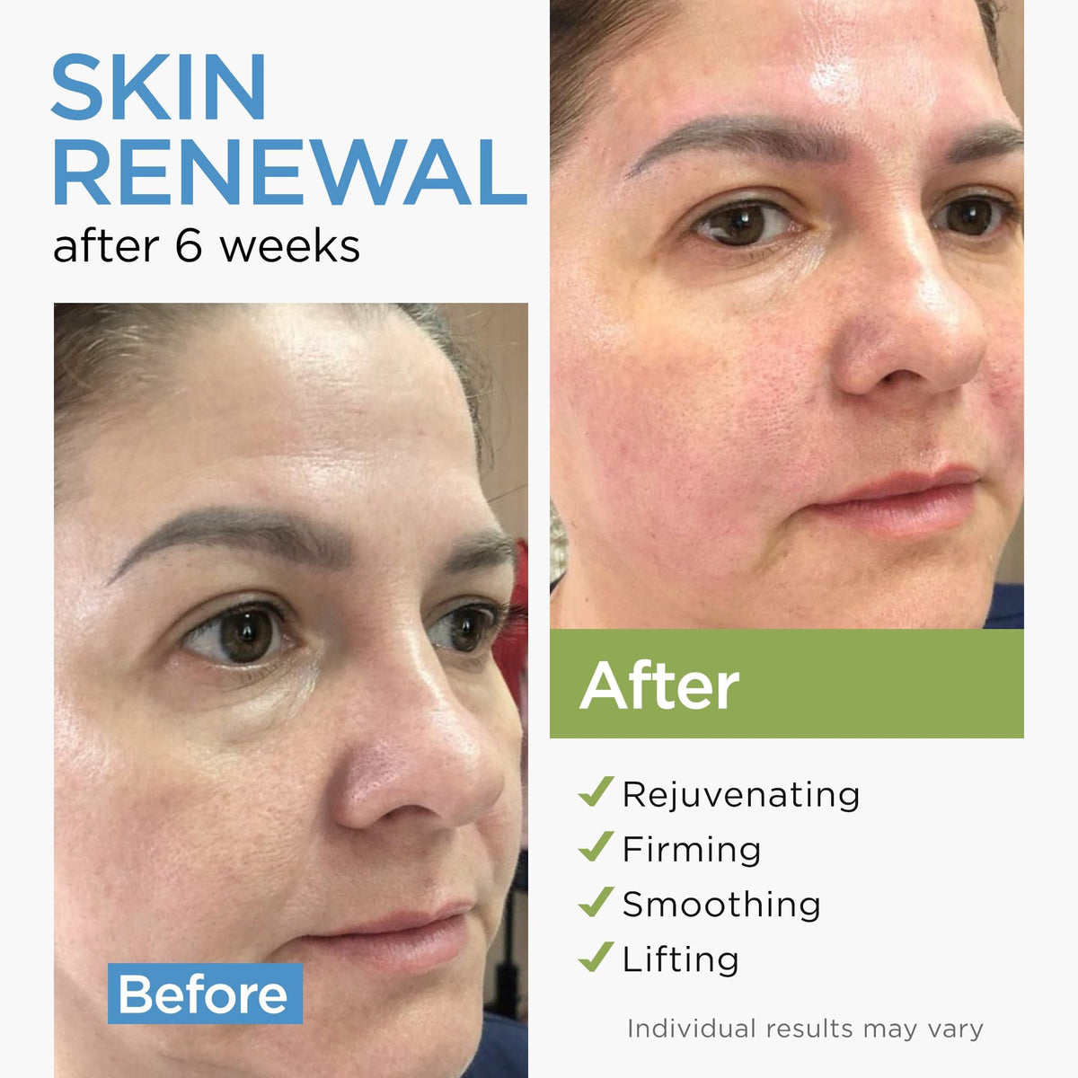 Ember Cloud Collagen Stem Cell Cream texture close-up