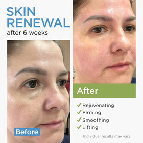 Ember Cloud Collagen Stem Cell Cream texture close-up