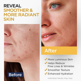 Ember Cloud Vitamin C Serum 8 Oz back view