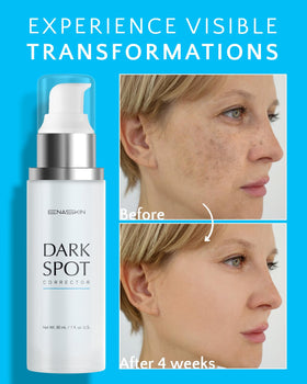 EnaSkin Dark Spot Corrector packaging side view