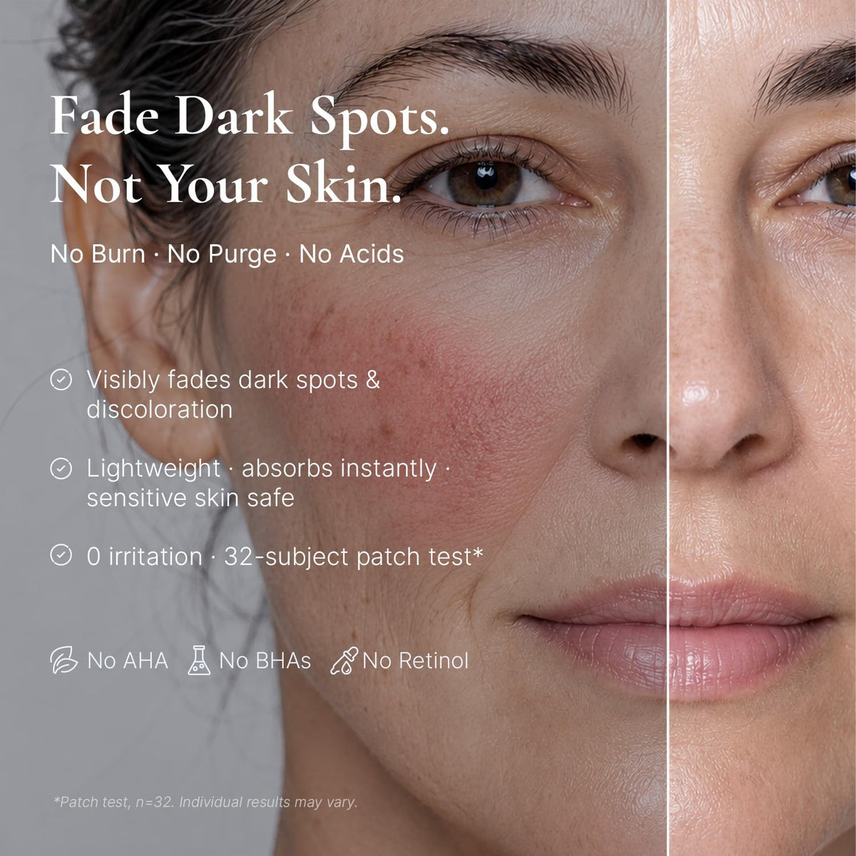EnaSkin Dark Spot Corrector Serum bottle with dropper
