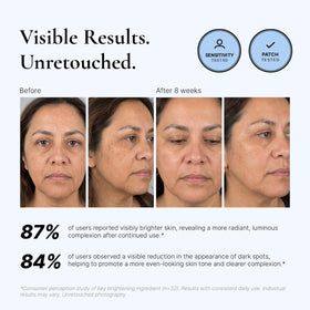 EnaSkin Dark Spot Corrector Serum texture on skin