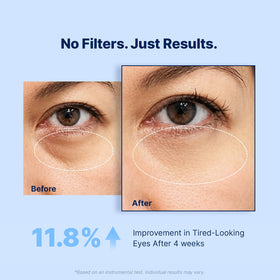 Enaskin Naturals Under Eye Patches in use during morning routine