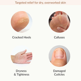 Epielle hand mask in use on hands