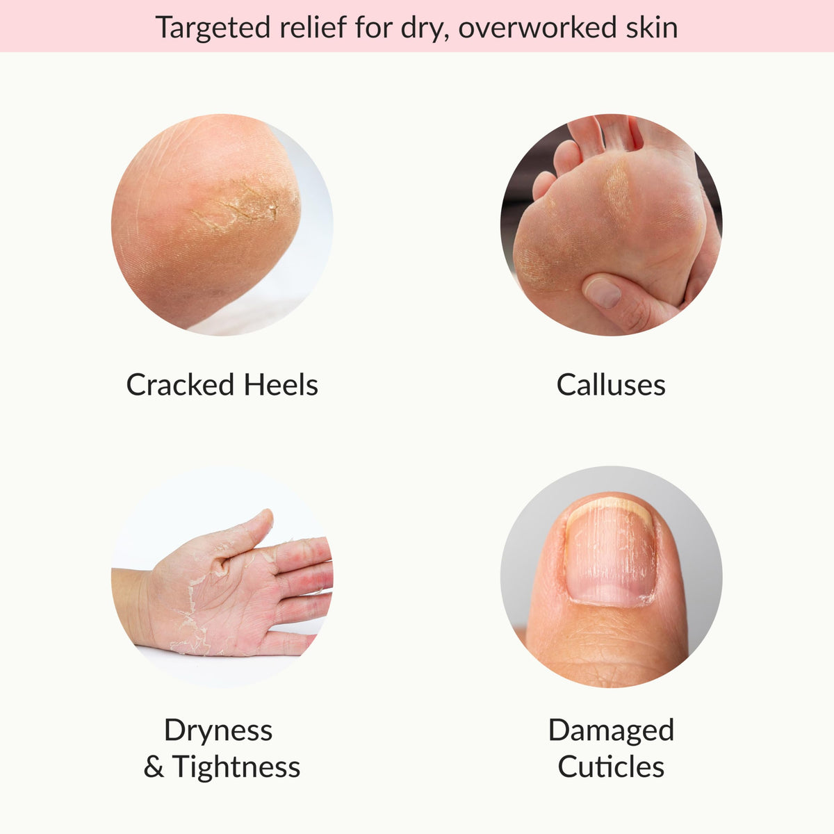 Epielle Moisturizing Socks with avocado oil on a wooden surface