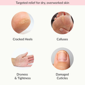 Epielle Moisturizing Socks with avocado oil on a wooden surface