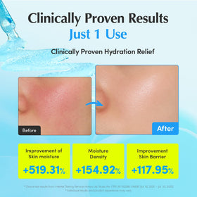EQQUALBERRY Hyaltoin Flooding Smoothie Serum texture on hand