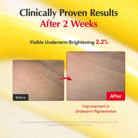 EQQUALBERRY Vitamin Illuminating Serum application on skin