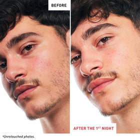 Erborian Skin Therapy Bi-Phase Night Oil-Serum packaging
