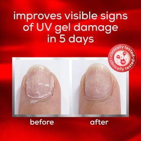 essie UV Gel Damage Repair application on bare nails