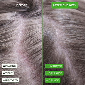 Ethique Scalp Health Shampoo Bar with natural ingredients