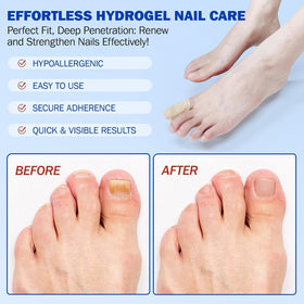FANSHI Nail Patches showing texture and thickness