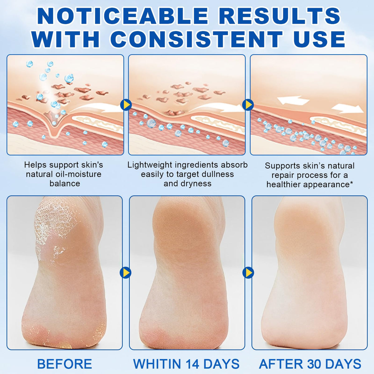 FANSHI Urea Stick 60% being applied to cracked heels