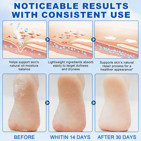 FANSHI Urea Stick 60% being applied to cracked heels