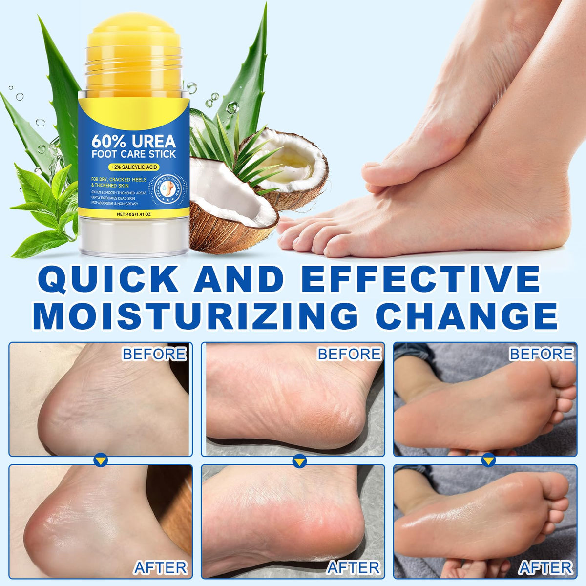 FANSHI Urea Stick 60% texture demonstration
