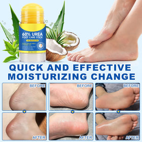 FANSHI Urea Stick 60% texture demonstration