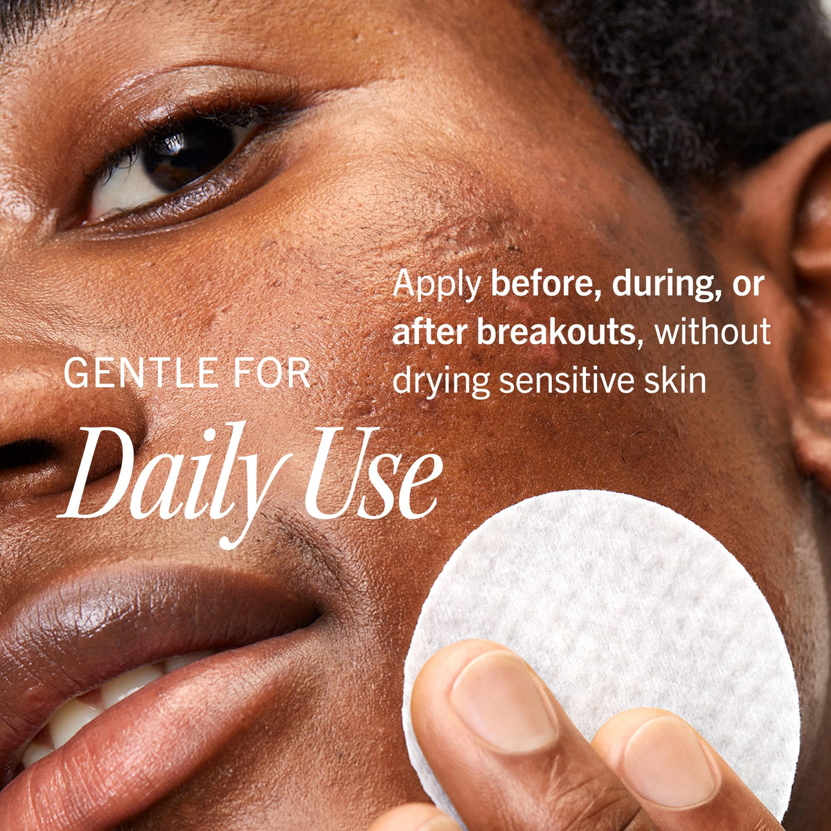 First Aid Beauty Acne Pads back view with ingredient list